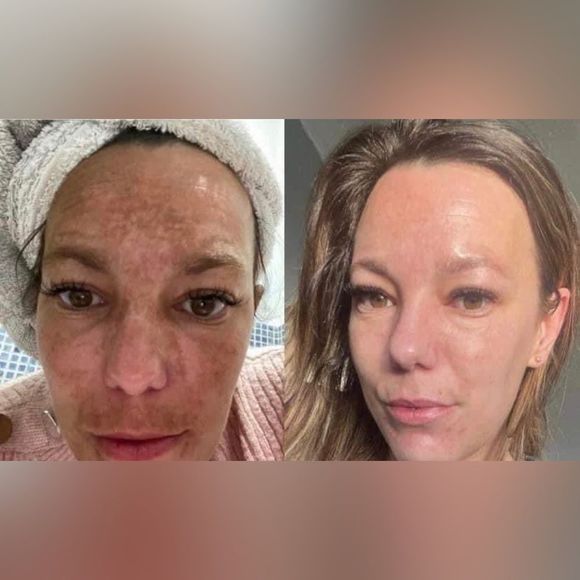 Two 180 Face Wash - Picture 3 of 14